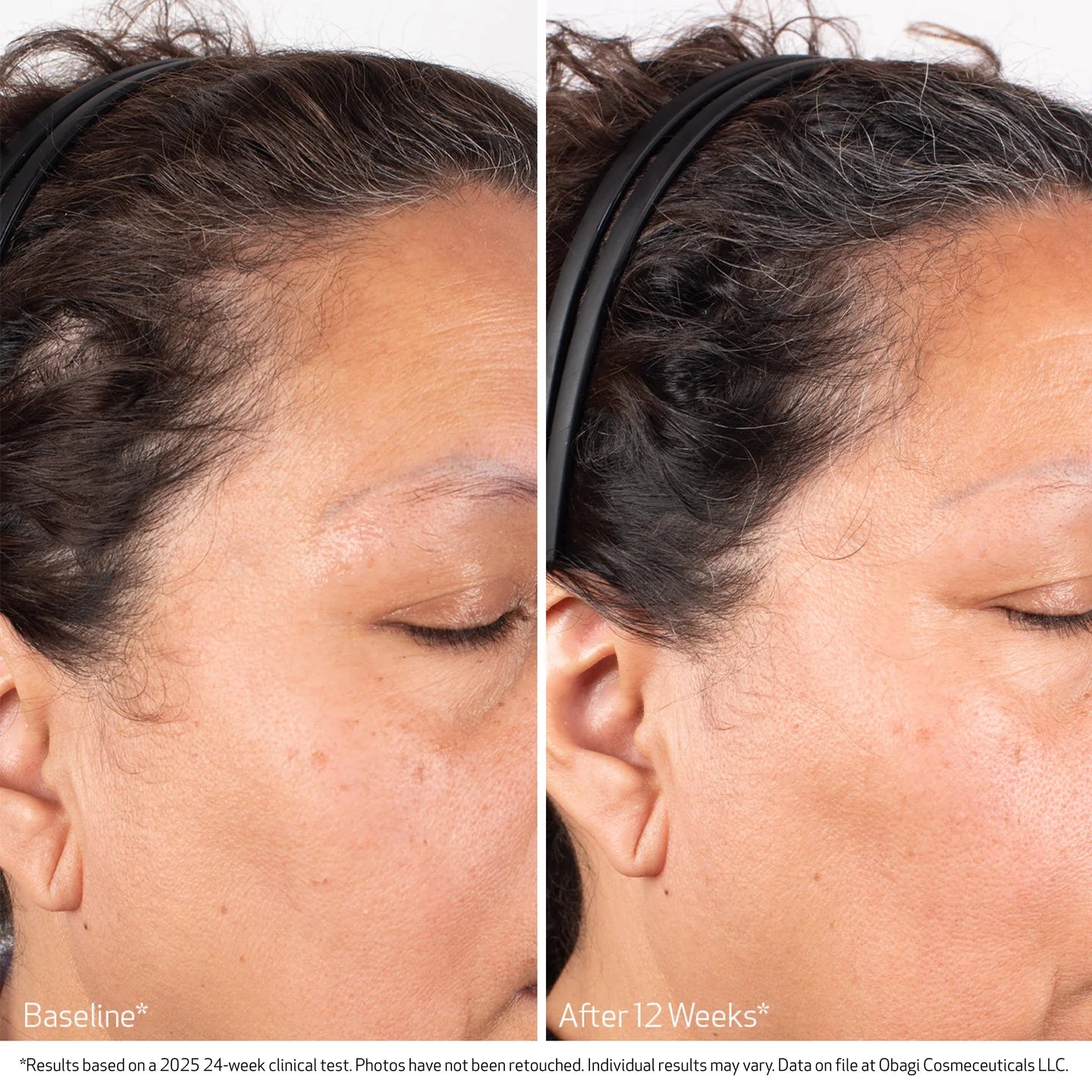 OBAGI Nu-Cil BIOSTIM Scalp Serum