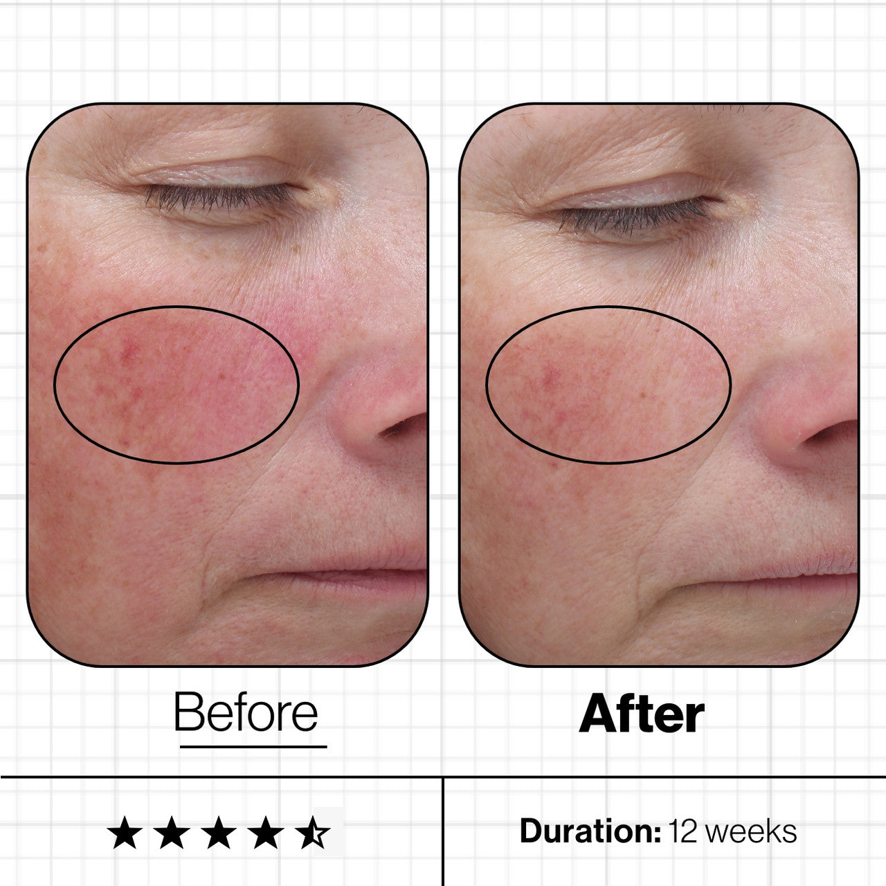 Skin Even IQ 28-Day Supply