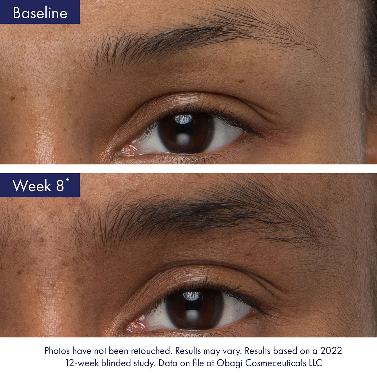 OBAGI Medical Nu-Cil EyeBrow Boosting Serum (BROW)
