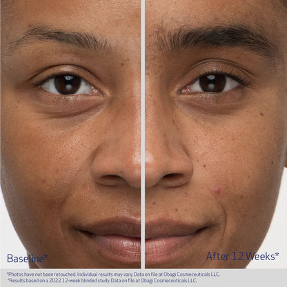 OBAGI Medical Nu-Cil EyeBrow Boosting Serum (BROW)