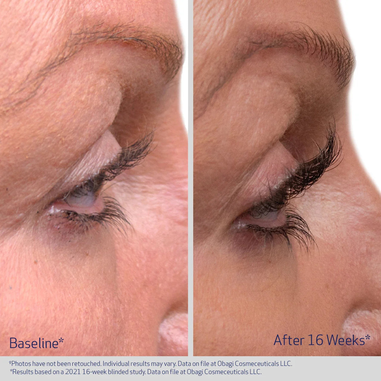 OBAGI Medical Nu-Cil Eyelash Enhancing Serum 3ml (LASH)