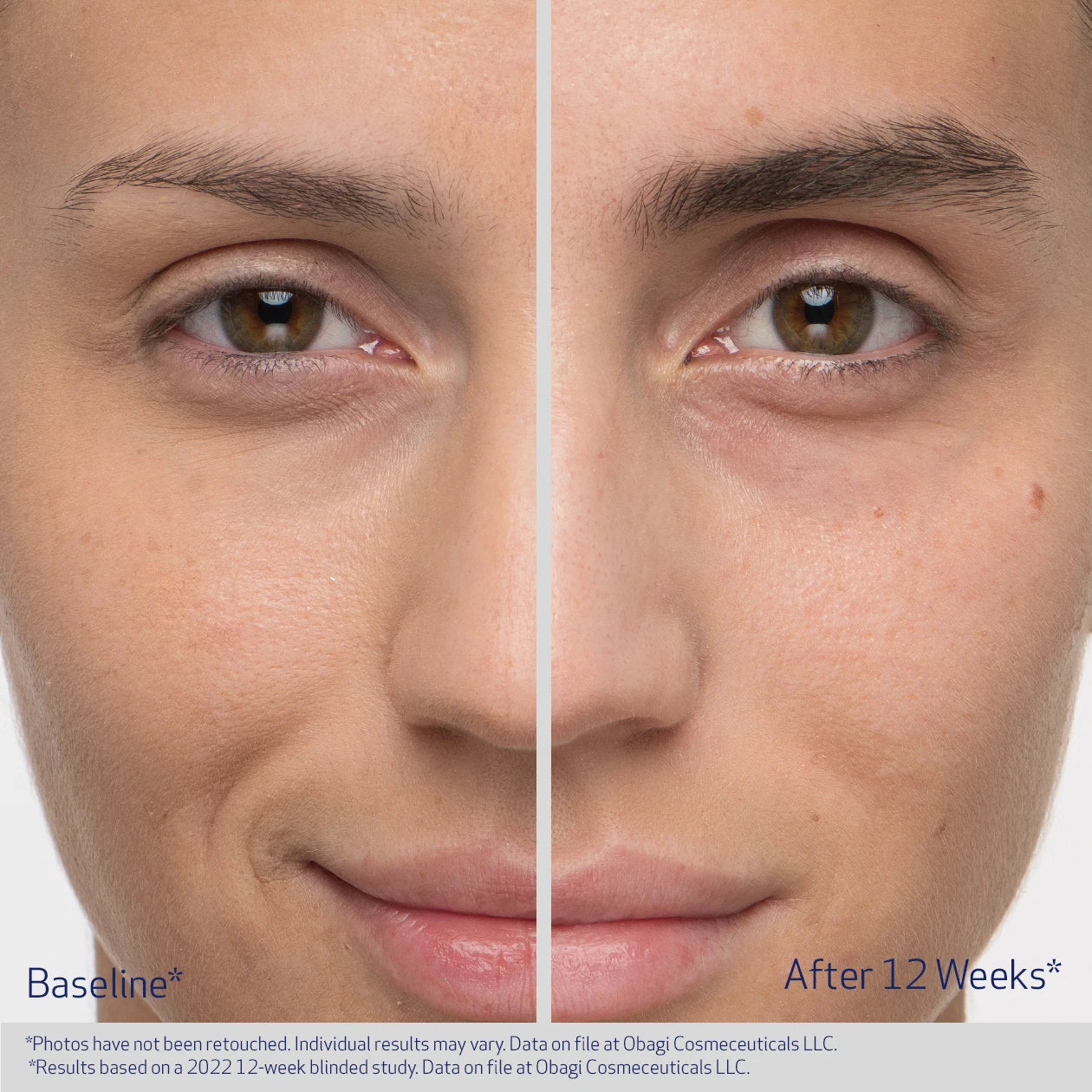 OBAGI Medical Nu-Cil EyeBrow Boosting Serum (BROW)