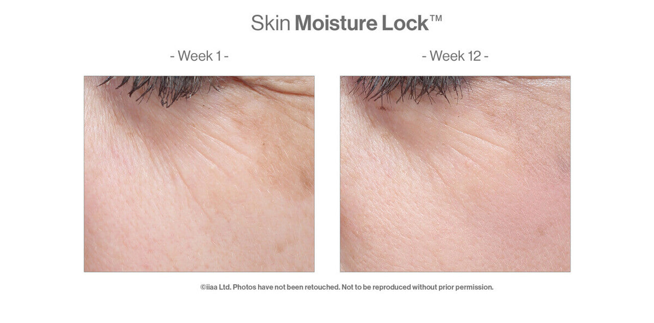 Skin Moisture Lock™