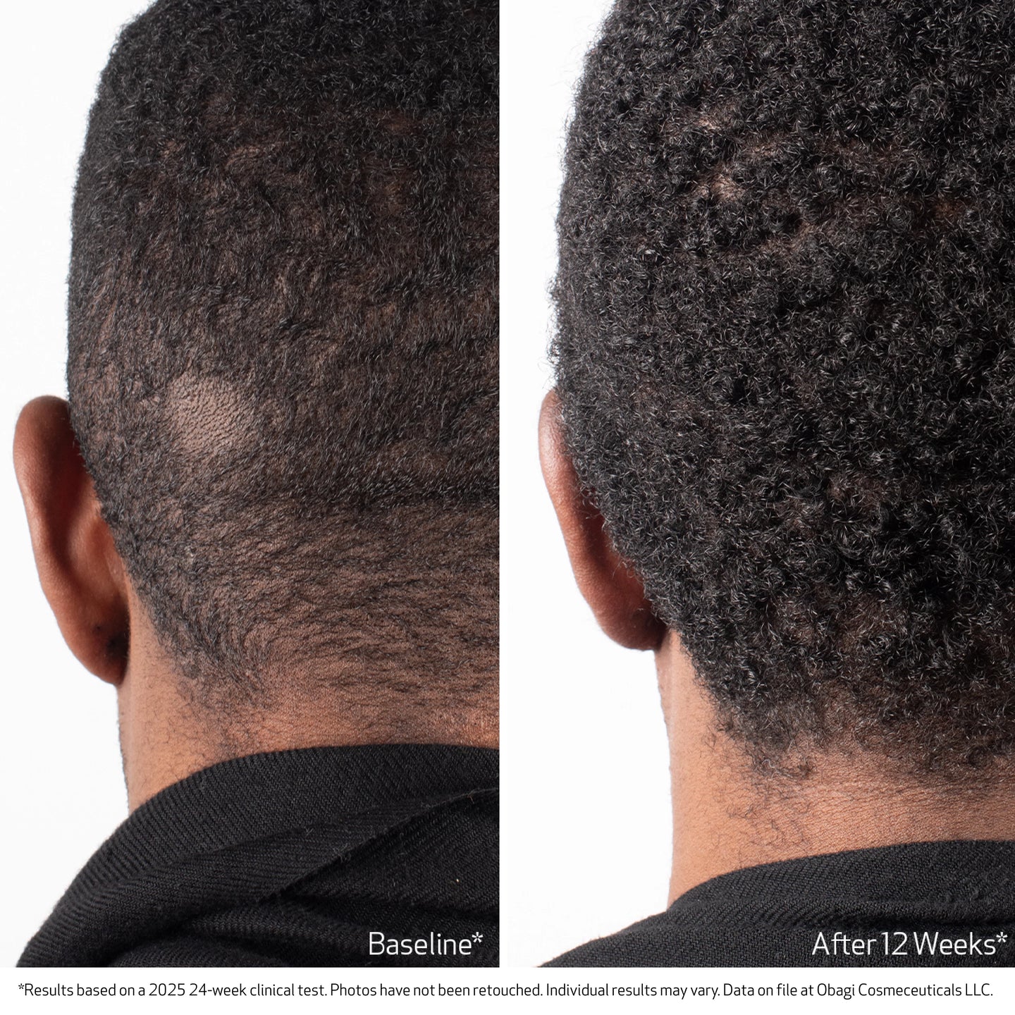 OBAGI Nu-Cil BIOSTIM Scalp Serum