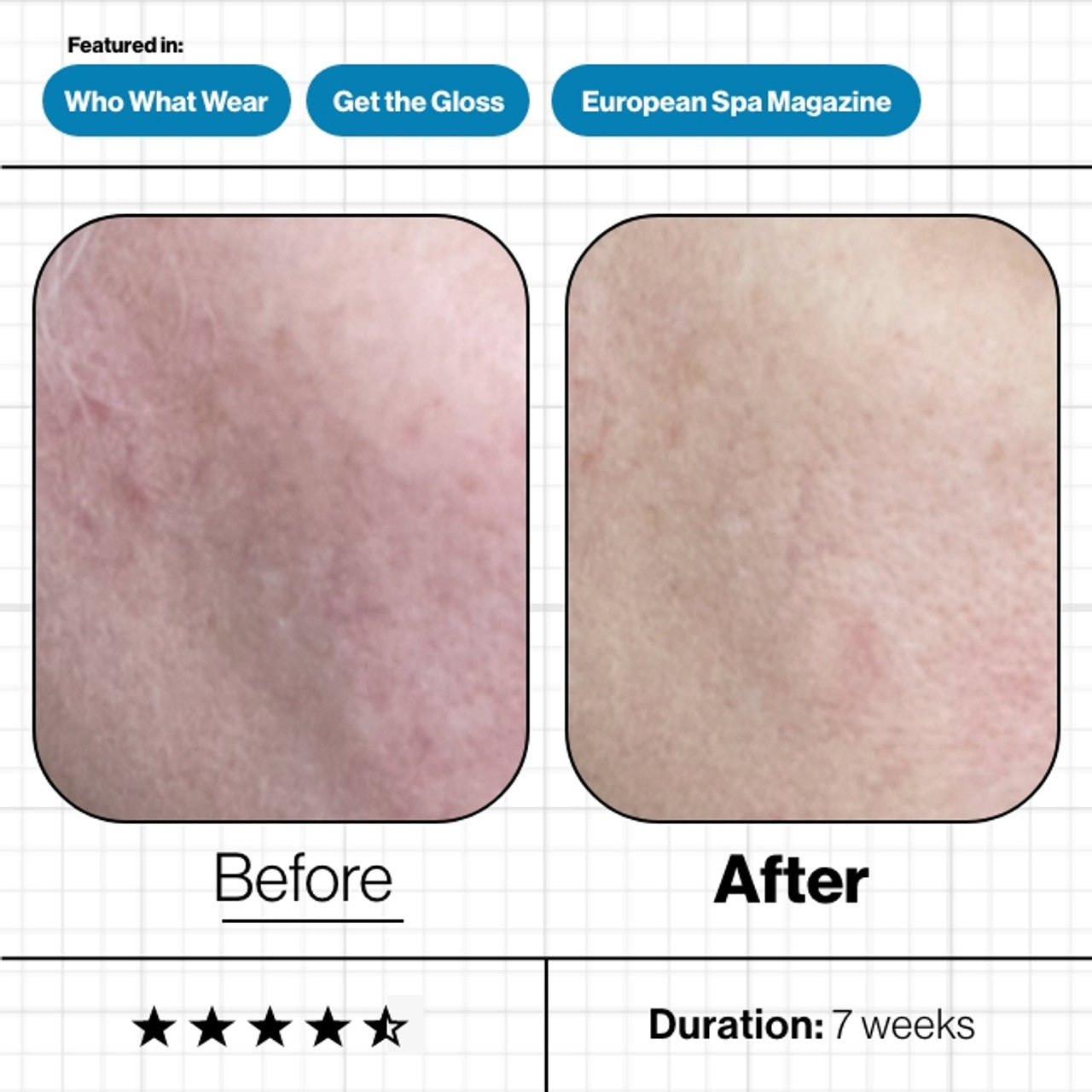 Skin Moisture IQ 28-Day Supply