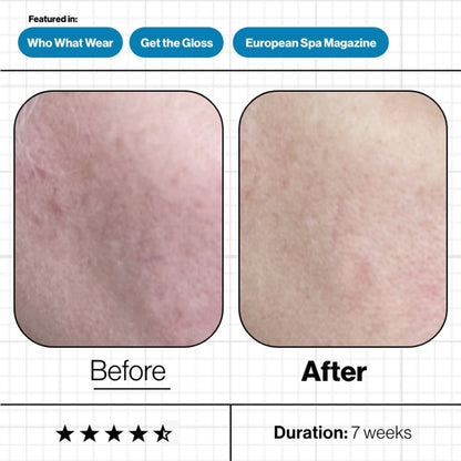 Skin Moisture IQ 28-Day Supply