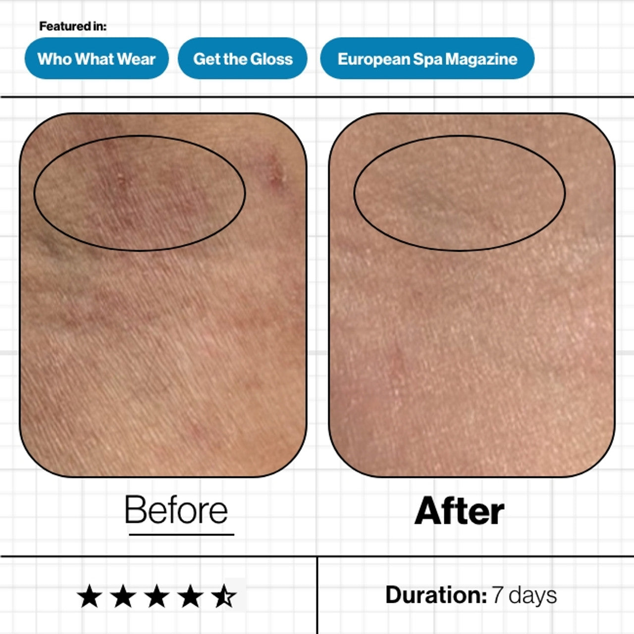 Skin Moisture IQ 28-Day Supply