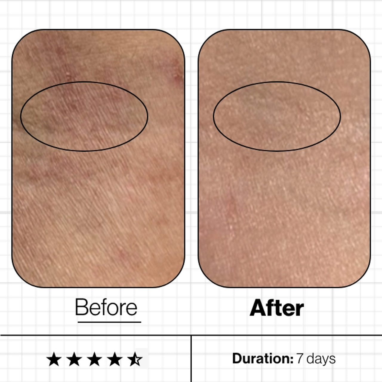 Skin Moisture IQ 28-Day Supply